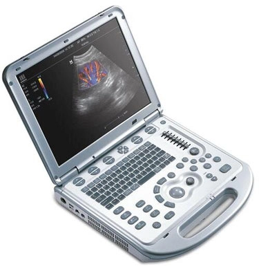 Chiropractic Frederick MD Muscuoloskeletal Ultrasound Monitor